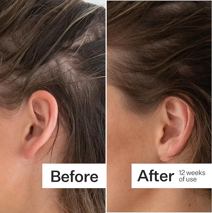 ACT+ ACRE Thick + Full Hair Capsules | Supplement for Thicker Fuller Looking Hair | Bamboo Horsetail Biotin Vitamin C | Strengthens Roots Vegan Gluten-Free Mint Essenced | 60ct