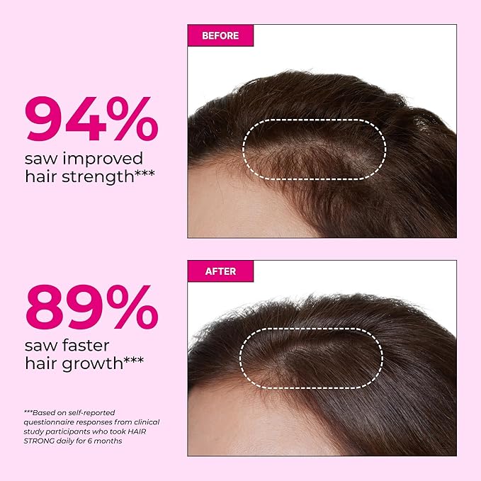 HUM Hair Strong Daily Hair Growth Supplement with Biotin Zinc Vitamin B12 to Support Growth Folic Acid &amp Vitamin B12 Vitamins for Healthy Hair Support for Women and Men 30 Vegan Capsules
