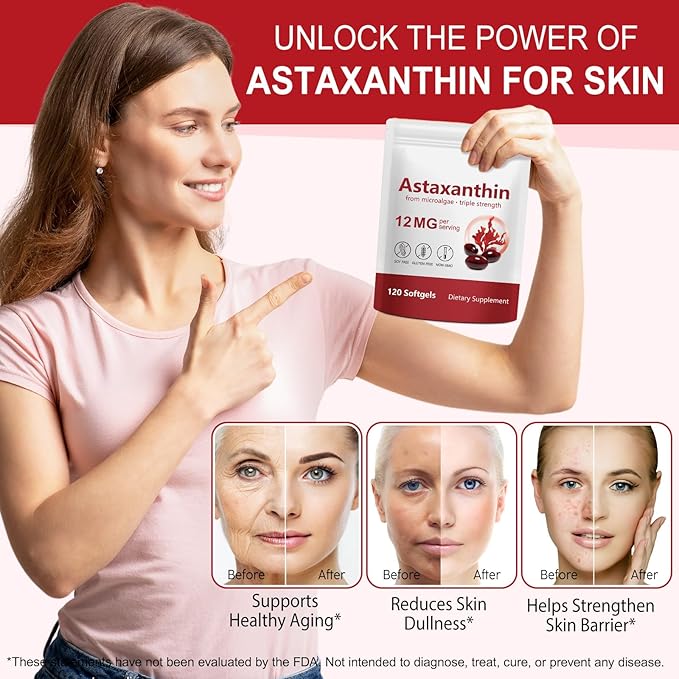 ITSDAWN Astaxanthin 12mg 2 Pack Antioxidant Supplement for Eye Skin Support Natural Microalgae Source 240 Softgels