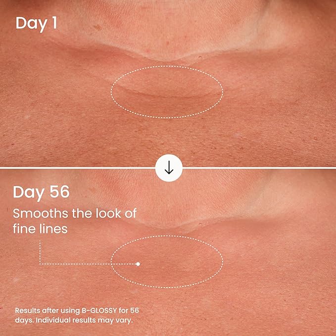 MAËLYS B-GLOSSY Smoothing Body Serum for Women - Hyaluronic Acid &amp Peptide Formula - Helps Reduce the Look of Wrinkles Texture &amp Crepey Skin - Lightweight Fast-Absorbing Anti-Aging Serum (2