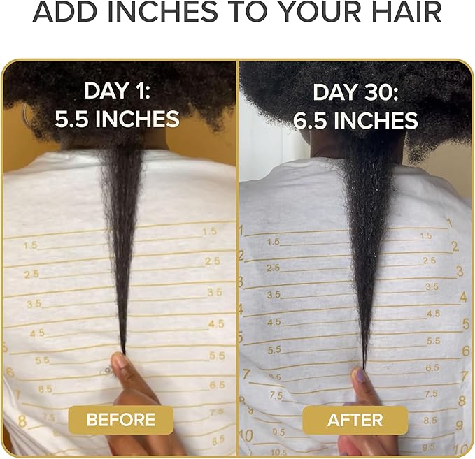 Shedavi Iconic Natural Hair Vitamins for Fast Hair Growth Pure Hair Supplements Formulated with Vitamins to Promote Thicker Stronger Hair - Vegan Hair Care for Hair Loss - (60 Capsules(Pack of 1))